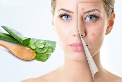 10 bài thuốc Ayurvedic tốt nhất để điều trị mụn trứng cá tại nhà