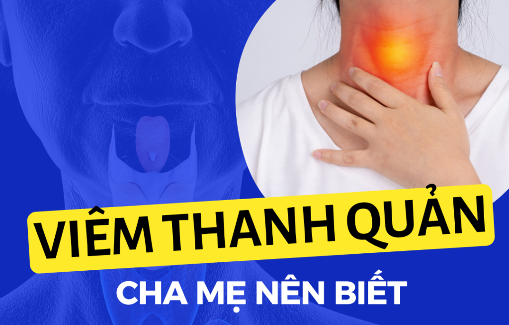 30 Viêm thanh quản, những điều cha mẹ nên biết Go1care