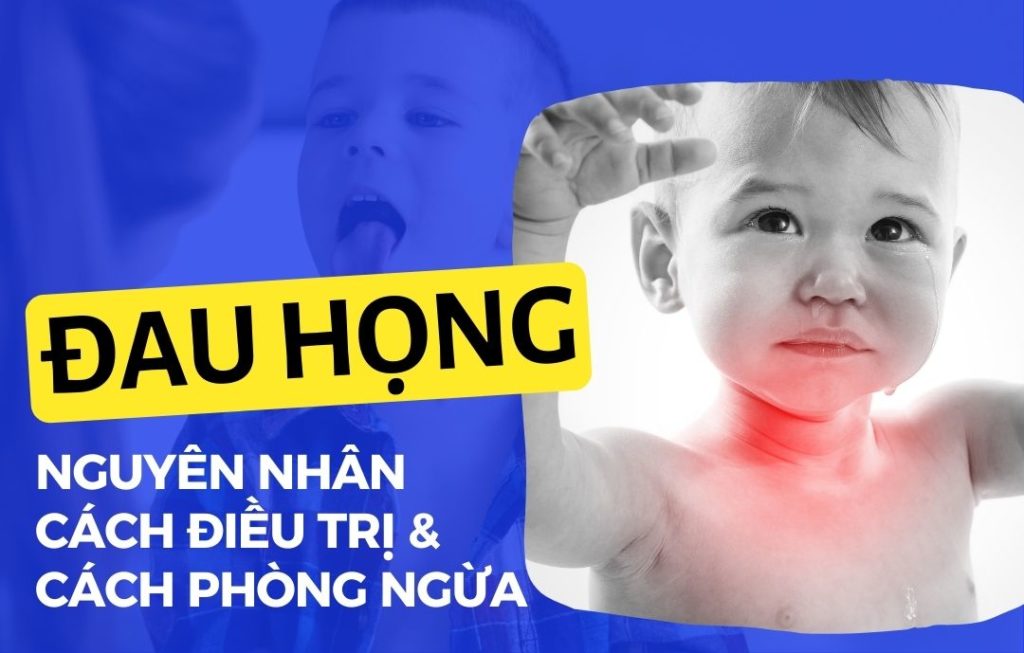 4 Đau họng - Nguyên nhân, cách điều trị và phòng ngừa Go1care