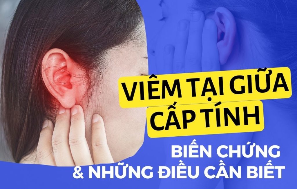 5 Viêm tai giữa cấp tính Go1care