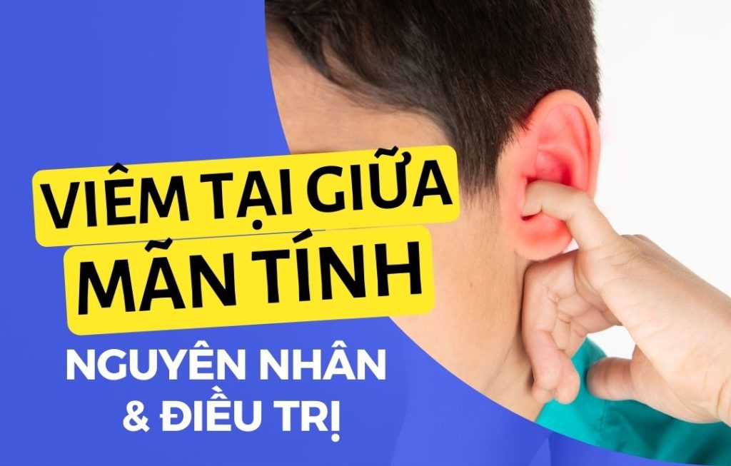 6 Viêm tai giữa mãn tính Go1care