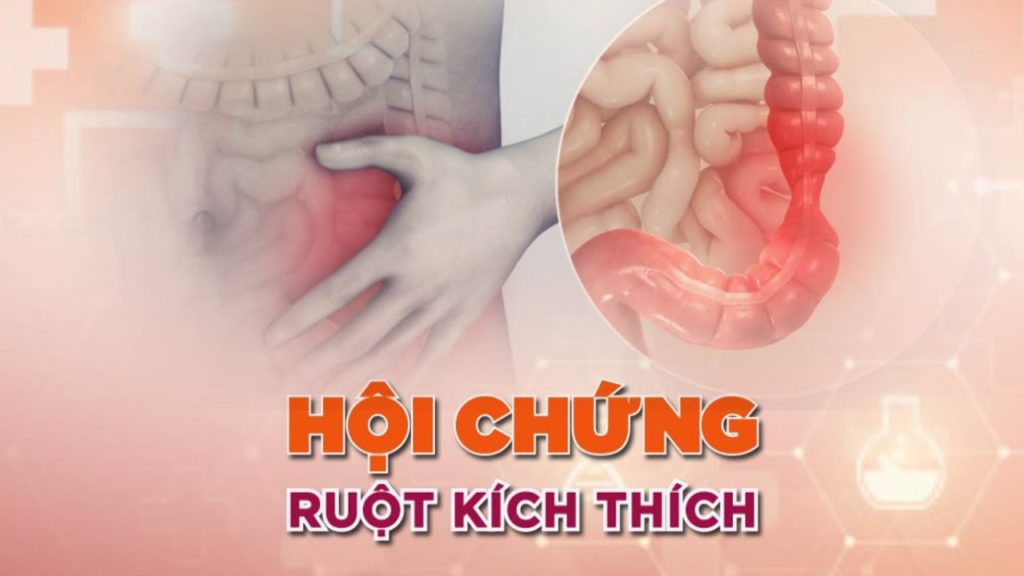 hoi chung ruot kich thich Hội chứng ruột kích thích là gì? Nguyên nhân và điều trị Go1care