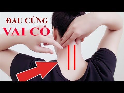 Đau mỏi cổ