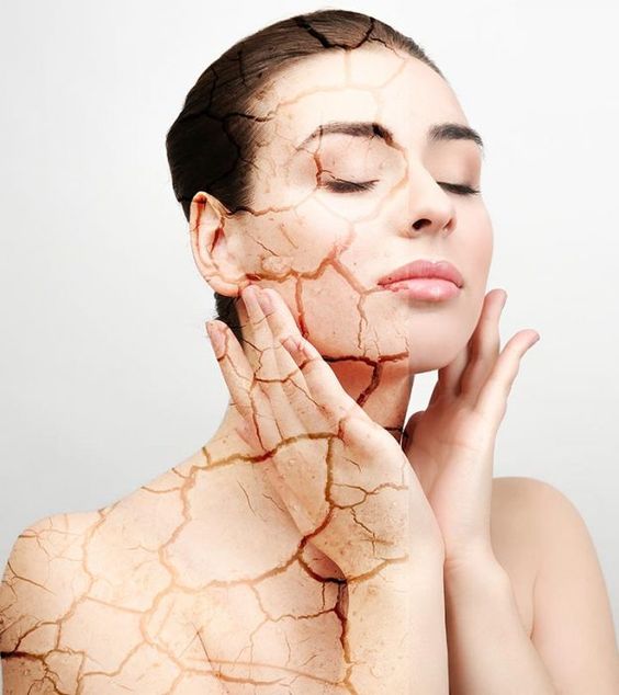 Cách sử dụng Multani Mitti cho da khô