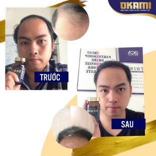 Okami-kol-before-after-thiết-kế-bannre-phạm-lãm-3