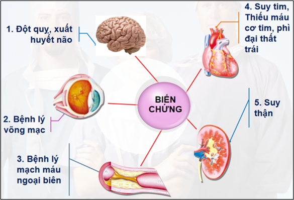 huyetap2 Cao Huyết Áp Là Gì? Nguyên Nhân Và Dấu Hiệu Nhận Biết Go1care