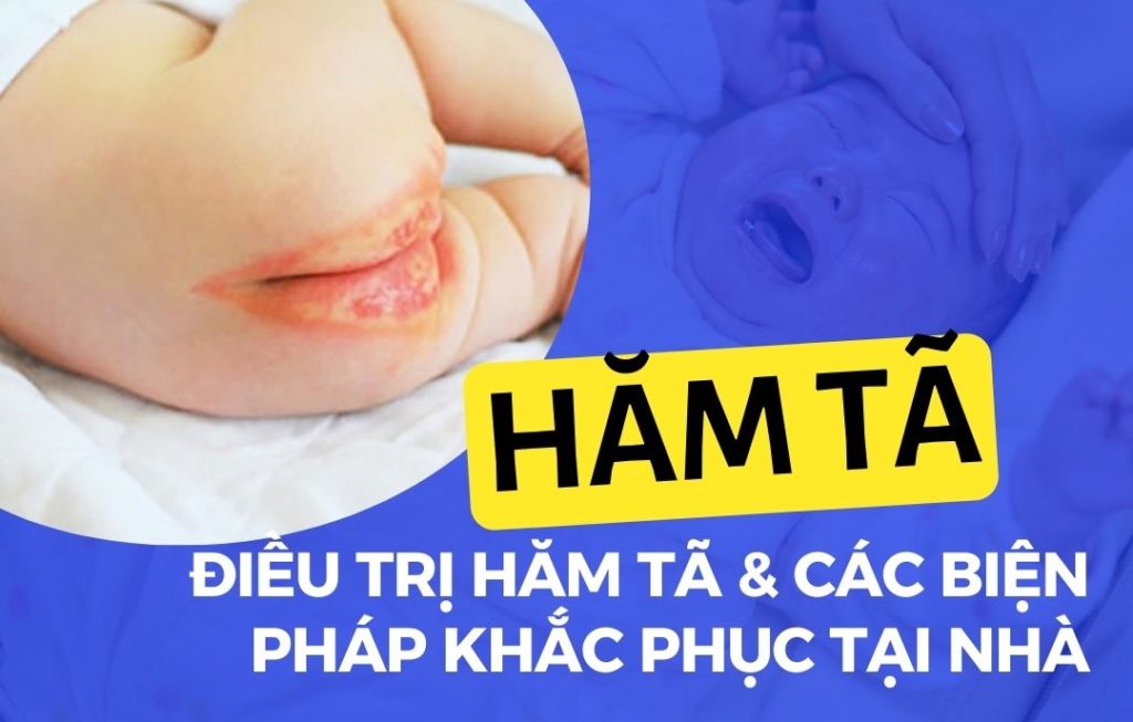 17 Hăm tã - Cách điều trị và các biện pháp khắc phục tại nhà Go1care