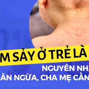 Bác sĩ CKI Đinh Thị Huyền Trang 21 Bác sĩ CKI Đinh Thị Huyền Trang Go1care