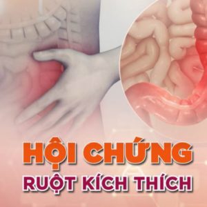 hoi chung ruot kich thich Dược sĩ Diệu Nguyễn Go1care