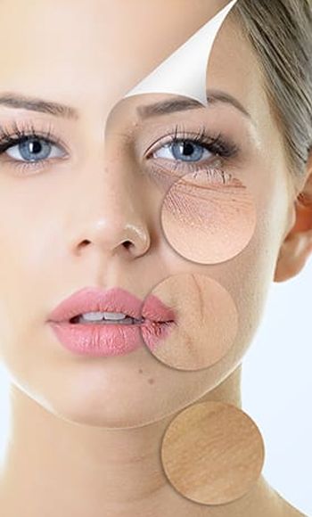 Bổ sung collagen để tăng độ đàn hồi cho làn da