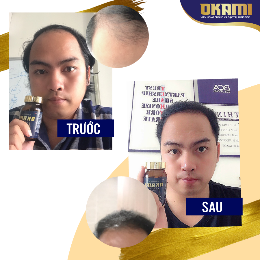 Okami-kol-before-after-thiết-kế-bannre-phạm-lãm-3