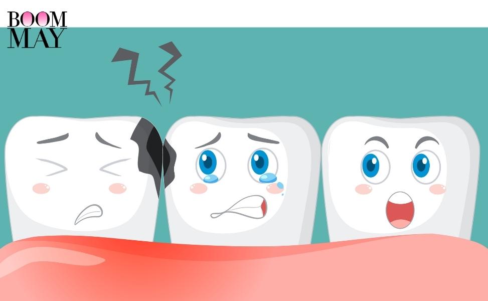 cach lam trang rang 16 Mục răng – nguyên nhân tiềm ẩn và cách phòng ngừa Go1care