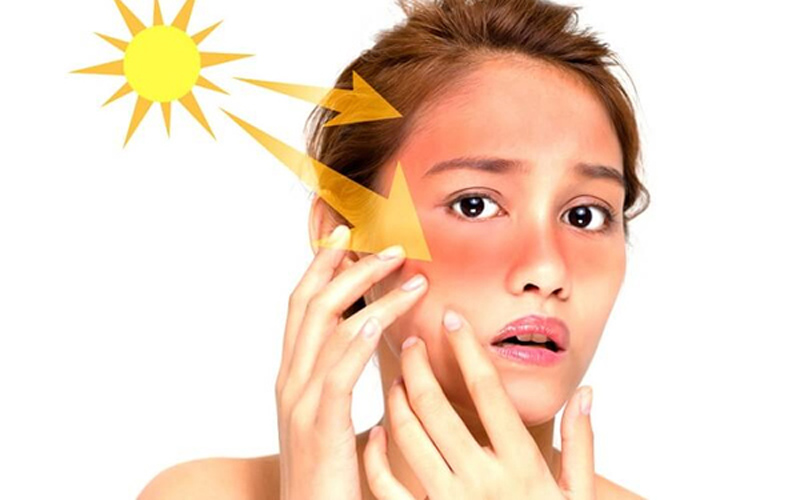 Tia UV sẽ làm tổn thương các tế bào da