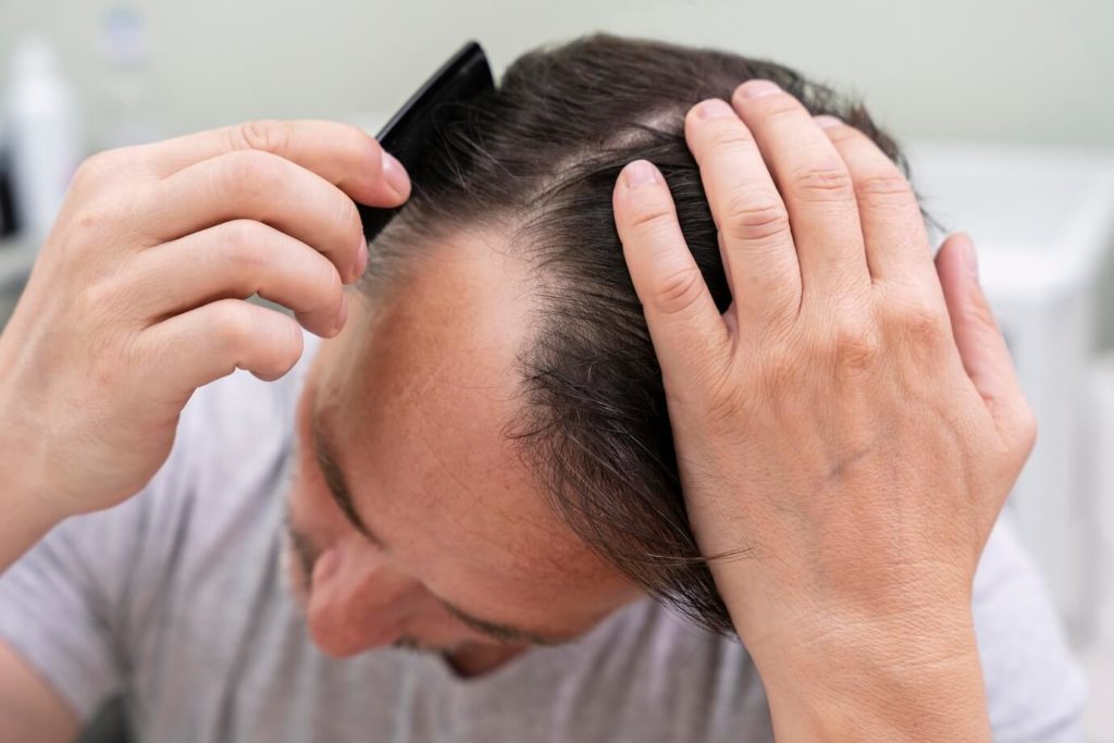 Các bước giúp phục hồi tóc khô xơ cho nam giới