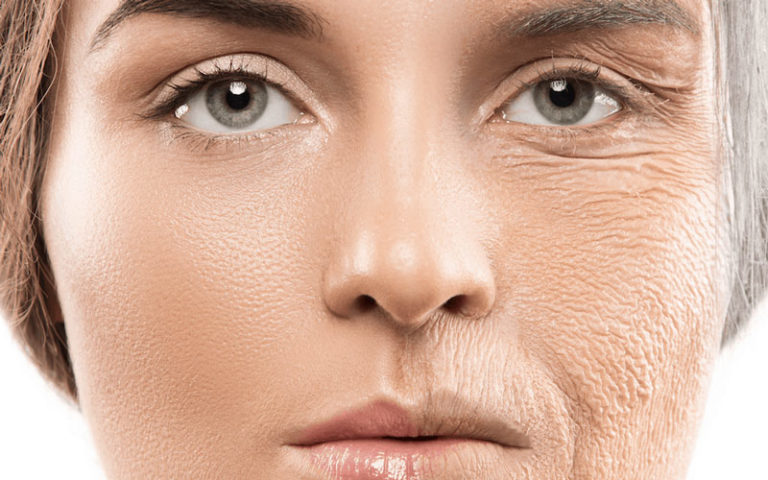 Bổ sung Collagen được xem là cách hưu hiệu nhất để ngăn ngừa lão hóa
