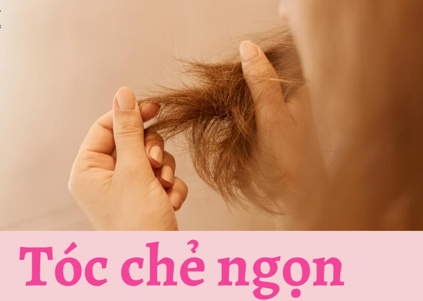 Tình trạng tóc crẻ ngọn thường gặp ở nhiều người go1care